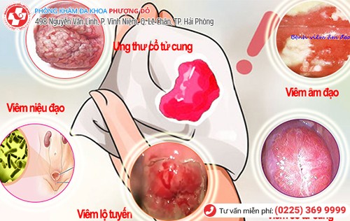 Nhiều bệnh liên quan đến âm đạo ra máu bất thường