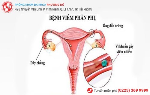 Tất tần tật những kiến thức mà chị em nên biết về bệnh phụ khoa