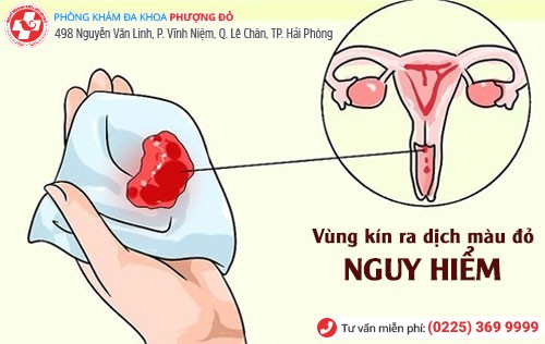 Biến chứng vùng kín ra dịch âm đạo