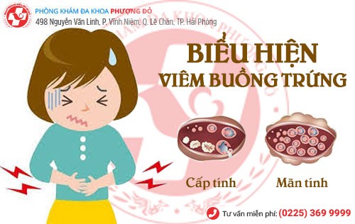 Biểu hiện viêm buồng trứng