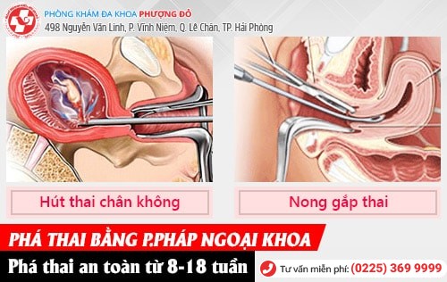 Cách làm sảy thai sớm khi có thai ngoài ý muốn