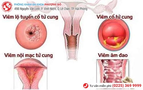 Chậm kinh ra máu nâu là bị làm sao?