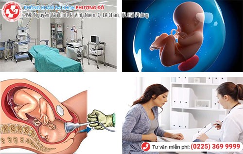 Yếu tố ảnh hưởng chi phí nạo thai