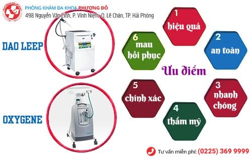 Phương pháp Oxygen O3, dao LEEP chữa rối loạn kinh nguyệt hiệu quả