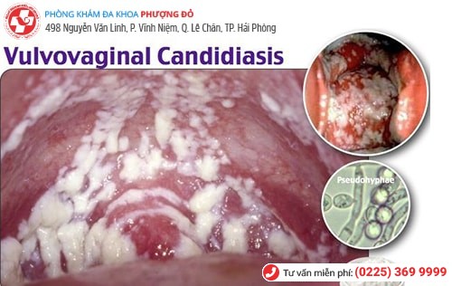 Đau bộ phận sinh dục nữ là bị làm sao? Có nguy hiểm không?