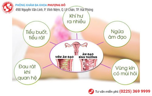 Những dấu hiệu bệnh phụ khoa cần đi khám ngay