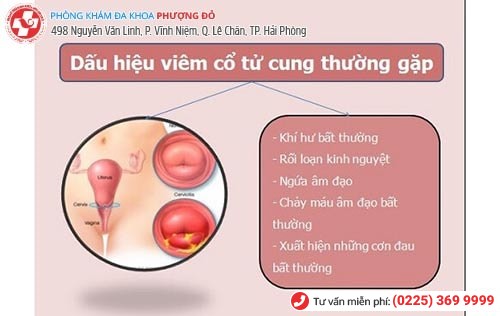 Các dấu hiệu viêm cổ tử cung