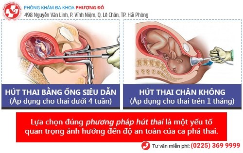 địa chỉ hút thai tại hải phòng đáng tin cậy