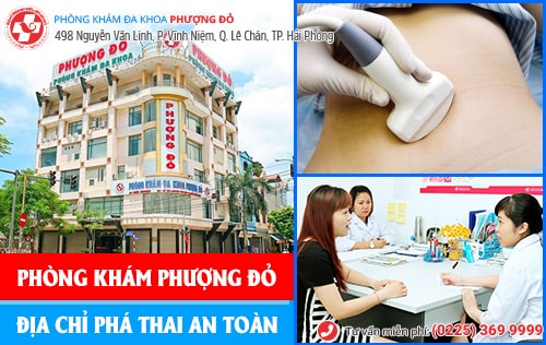 Thuốc phá thai khẩn cấp giá bao nhiêu?