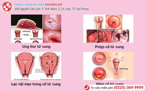 “Đứng ngồi không yên” vì kinh nguyệt kéo dài tận 3 tuần