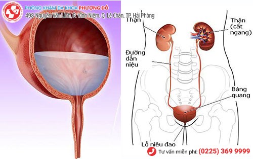 viêm đường tiểu ở nữ 