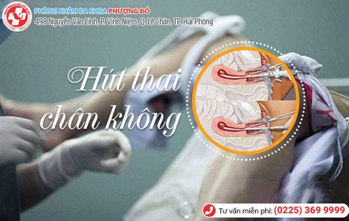 Để đảm bảo hút thai chân không an toàn cần siêu âm, kiểm tra kỹ lưỡng