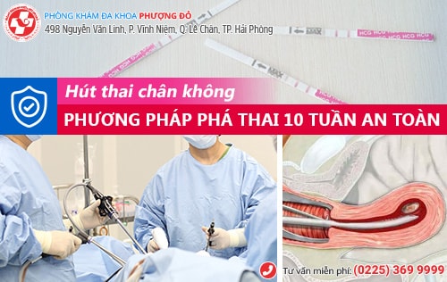 Thai 10 tuần có bỏ được không?