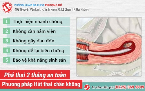 Phá thai 2 tháng có được không? Phương pháp phá thai 2 tháng an toàn