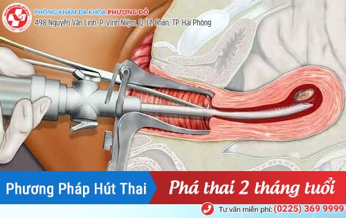 Phá thai 1 tháng, phá thai 2 tháng bằng phương pháp nào an toàn?