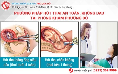 Phương pháp hút thai không đau