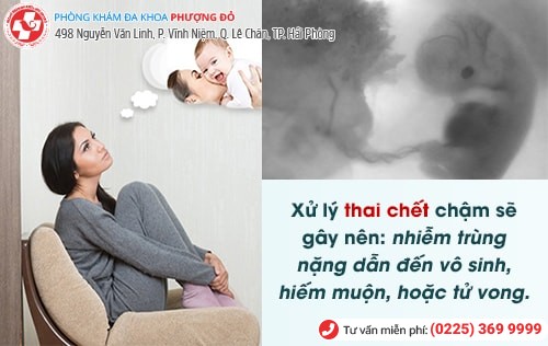 Cách hút thai lưu và tầm quan trọng phải hút thai lưu