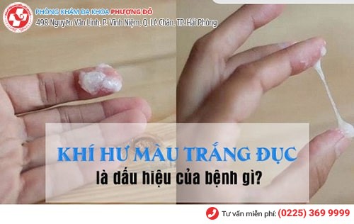 Khí hư màu trắng là dấu hiệu nhiều bệnh nguy hiểm