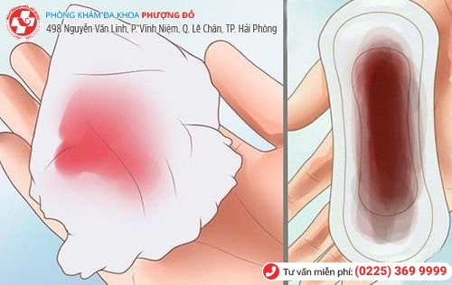 Máu kinh ra nhiều có thể gây vô sinh ở nữ giới