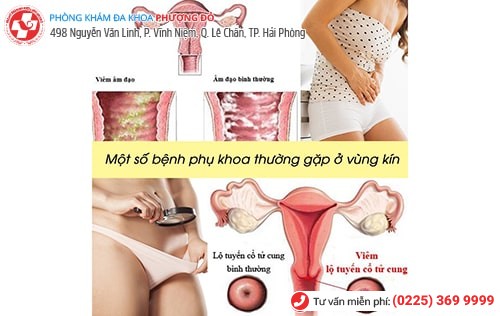 1 số bệnh phụ khoa ở vùng kín thường gặp ở chị em