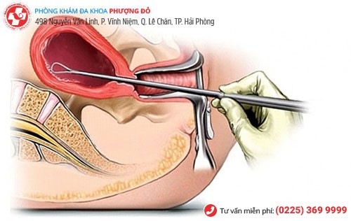 Nạo hút thai cần thực hiện ở các cơ sở y tế đảm bảo phòng tránh biến chứng