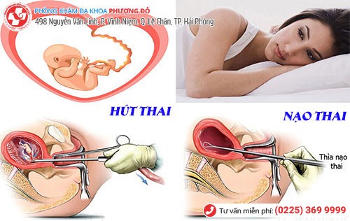 1 số phương pháp nạo thai an toàn Phượng Đỏ áp dụng