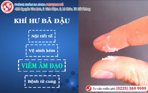 Nguyên nhân khí hư bã đậu