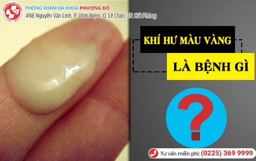 Khí hư màu vàng là bệnh gì?