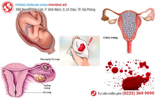 nguyên nhân ra máu thai kỳ