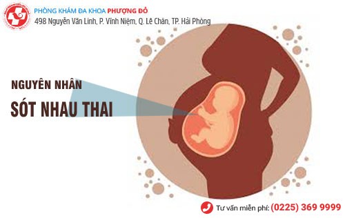 Nguyên nhân sót nhau thai