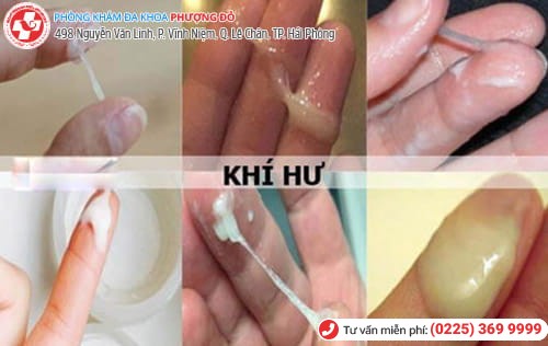 biểu hiện nấm âm đạo