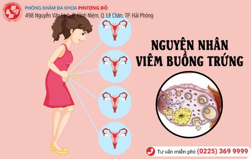 Viêm buồng trứng