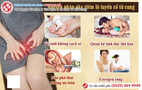 1 số nguyên nhân gây viêm lộ tuyến chính