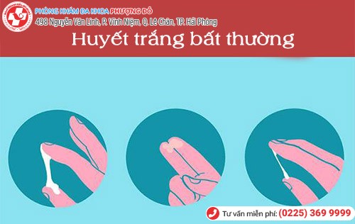 huyết trắng bất thường