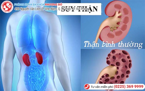 suy thận do nhiễm trùng đường tiểu gây ra