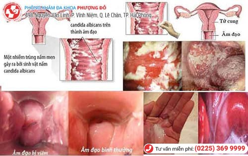 Nước tiểu màu đỏ - Cảnh báo những căn bệnh nguy hiểm