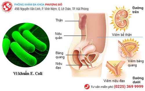 Nước tiểu màu đỏ - Cảnh báo những căn bệnh nguy hiểm