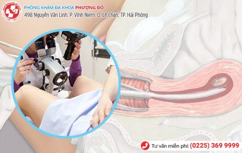 phá thai 10 tuần