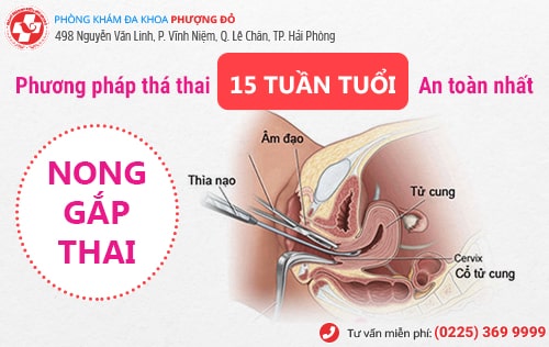 Phá thai 15 tuần có được không?