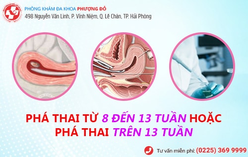 Cách phá thai từ 8 đến 13 tuần, phá thai trên 13 tuần an toàn, không đau