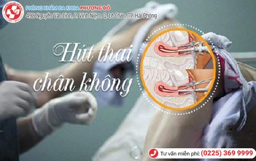 Phương pháp hút thai chân không dành cho thai đã lớn