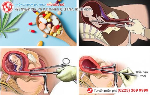 Các phương pháp phá thai nhanh, tốt, an toàn hiện nay