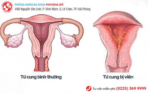 Phải làm gì sau khi quan hệ bị ngứa?