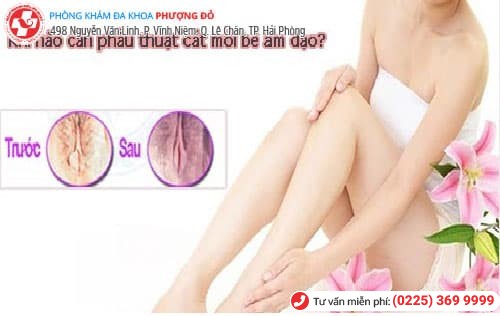 phẫu thuật cắt môi bé có đau không