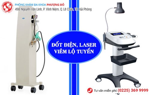 Phương pháp đốt viêm lộ tuyến