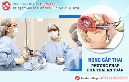 Phương pháp nong gắp thai