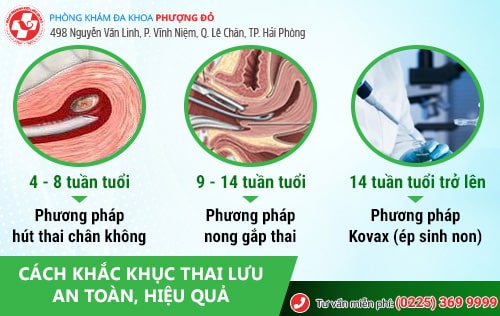 Cách nhận biết thai chết lưu và cách khắc phục