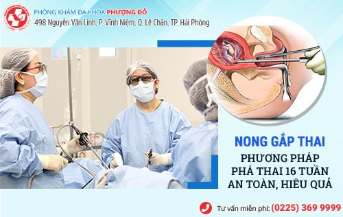 Thai 16 tuần có phá được không?