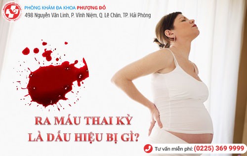 ra máu thai kỳ