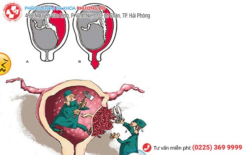 Nhận biết các dấu hiệu sót nhau thai sớm để can thiệp kịp thời